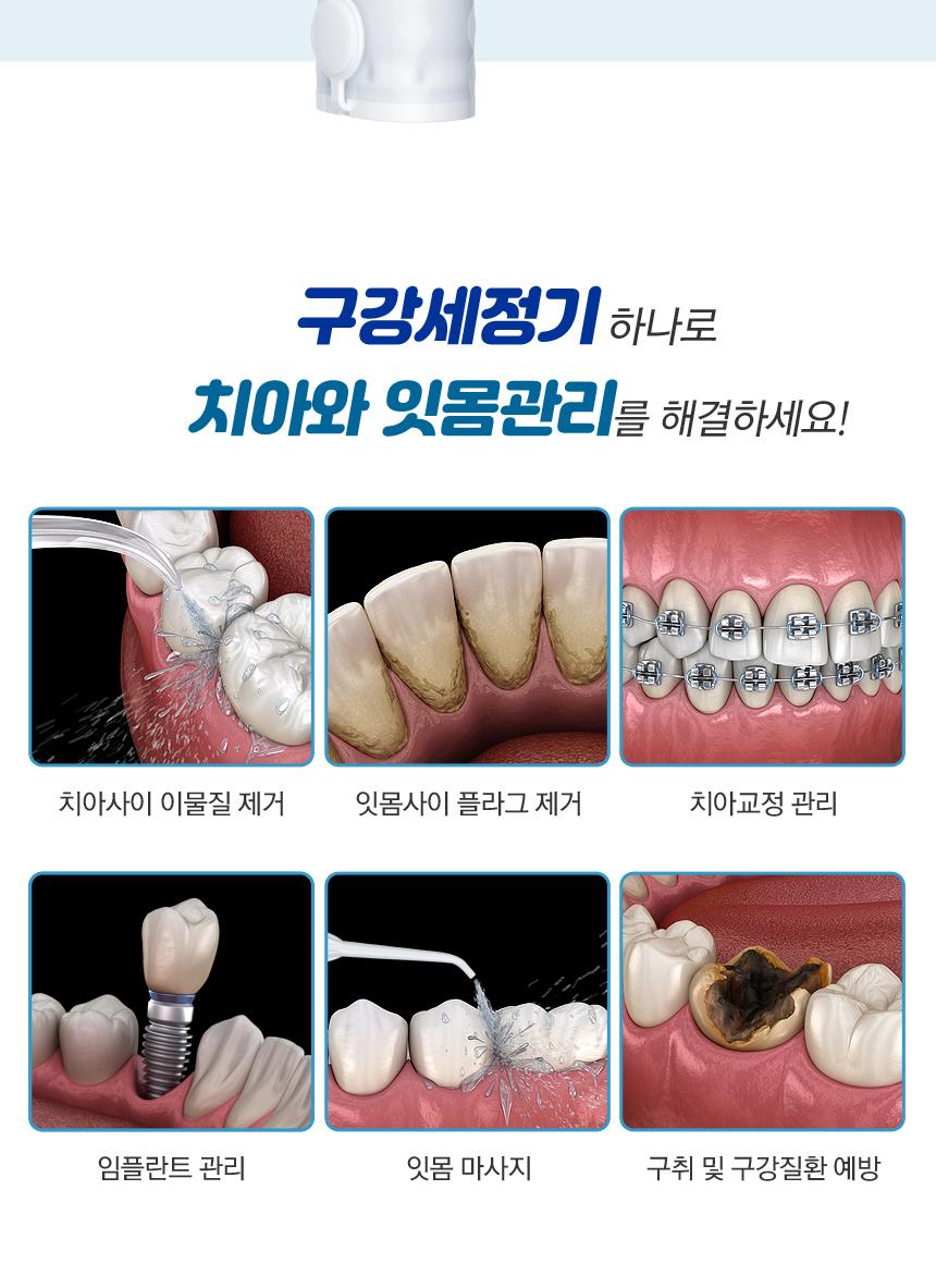 [에스로체] 아쿠아랩 구강세정기 상세 이미지 9